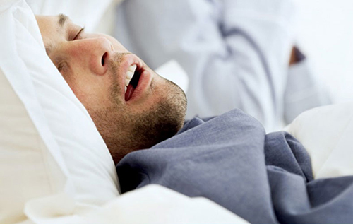 sleep apnea